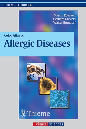 Color Atlas of Allergic Diseases - Martin Rocken - Gerhard Grevers - Walter Burgdorf - Jurgen Behr