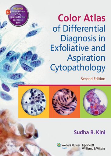 Color Atlas of Differential Diagnosis in Exfoliative and Aspiration Cytopathology - Sudha R. Kini