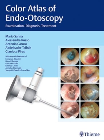 Color Atlas of Endo-Otoscopy - Mario Sanna - Alessandra Russo - Antonio Caruso - Abdelkader Taibah - Gianluca Piras