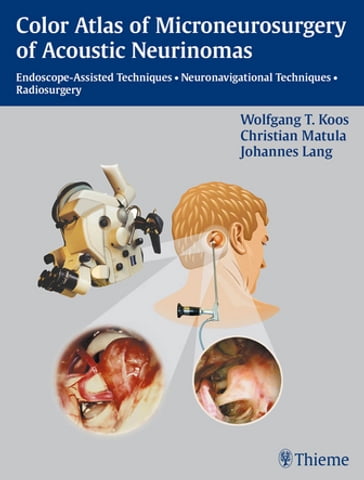 Color Atlas of Microsurgery of Acoustic Neurinomas - W. Koos - Christian Matula - Johannes Lang