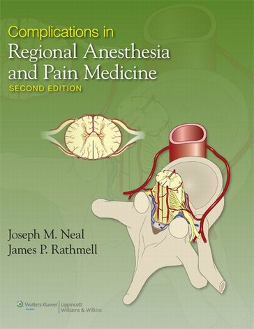 Complications in Regional Anesthesia and Pain Medicine - James P. Rathmell - Joseph Neal