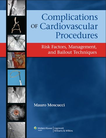 Complications of Cardiovascular Procedures - Mauro Moscucci