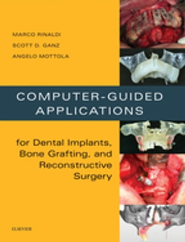 Computer-Guided Dental Implants and Reconstructive Surgery - Marco Rinaldi - Scott D Ganz - Angelo Mottola