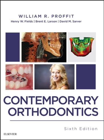 Contemporary Orthodontics - E-Book - DDS  PhD William R. Proffit - DMD  MS David M. Sarver - DDS  MS Brent Larson - DDS  MS  MSD Henry Fields