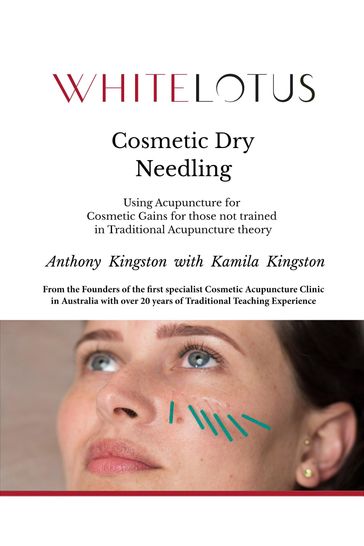 Cosmetic Dry Needling: Using Acupuncture for Cosmetic Gains for Those Not Trained in Traditional Acupuncture Theory - Anthony Kingston
