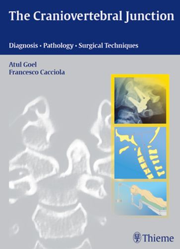 Craniovertebral Junction - Atul Goel - Francesco Cacciola