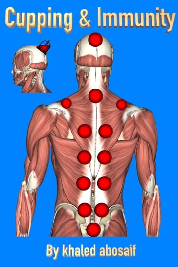 Cupping & Immunity - khaled abosaif