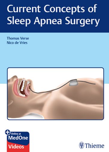 Current Concepts of Sleep Apnea Surgery