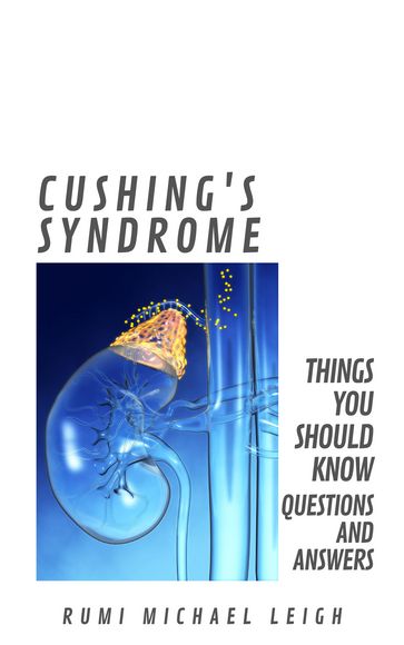 Cushing's Syndrome - Rumi Michael Leigh