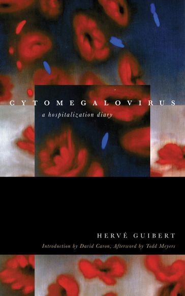 Cytomegalovirus - Hervé Guibert - Todd Meyers