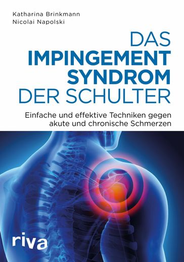 Das Impingement-Syndrom der Schulter - Katharina Brinkmann - Nicolai Napolski