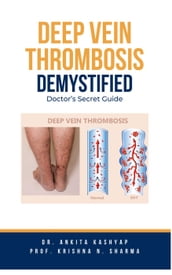 Deep Vein Thrombosis Demystified: Doctor s Secret Guide