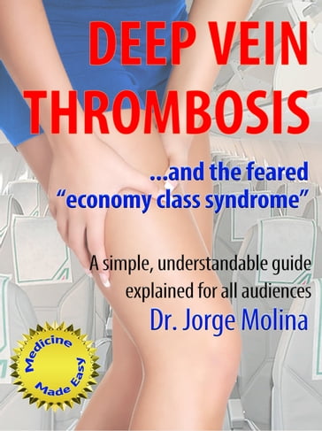 Deep Vein Thrombosis - Jorge Molina