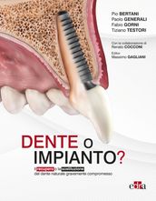 Dente o impianto?