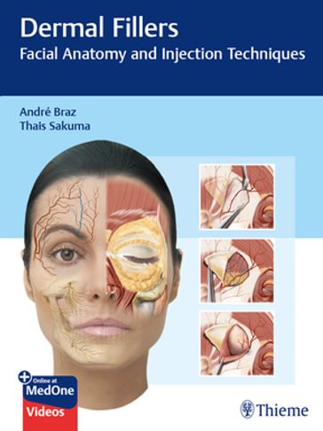 Dermal Fillers - André Vieira Braz - Thais Harumi Sakuma