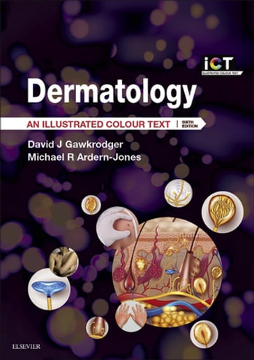 Dermatology E-Book - David Gawkrodger - DSc - MD - FRCP - FRCPE