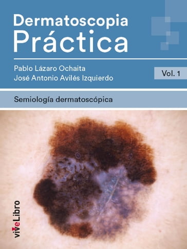 Dermatoscopia Práctica. Vol. 1: Semiología Dermatoscópica - José Antonio Avilés Izquierdo - PABLO LÁZARO OCHAITA