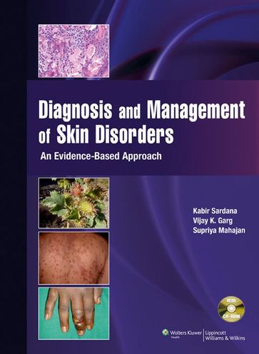 Diagnosis & Management of Skin Disorders - Kabir Sardana