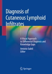 Diagnosis of Cutaneous Lymphoid Infiltrates