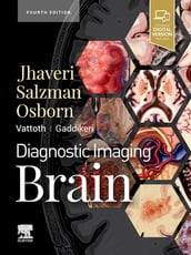 Diagnostic Imaging: Brain E-Book