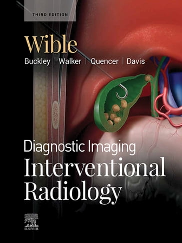 Diagnostic Imaging: Interventional Radiology E-Book - MD Brandt C. Wible