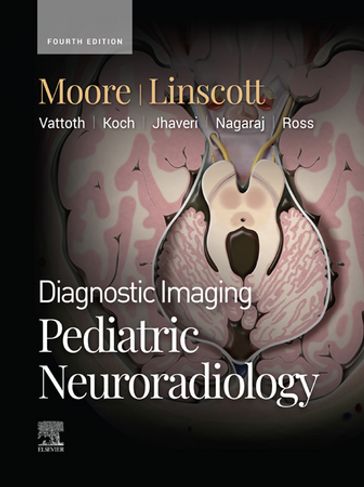 Diagnostic Imaging: Pediatric Neuroradiology - E-BOOK - MD Kevin R. Moore - MD Luke L. Linscott