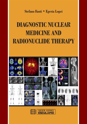 Diagnostic Nuclear Medicine and Radionuclide Therapy - Egesta Lopci - Stefano Fanti