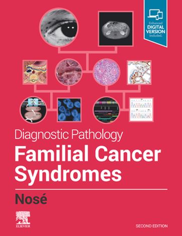 Diagnostic Pathology: Familial Cancer Syndromes E-Book - Vania Nosé - MD - PhD