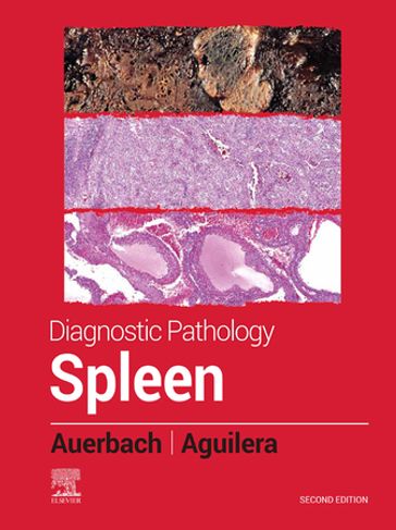 Diagnostic Pathology: Spleen - E-Book - MD  MPH Aaron Auerbach - MD Nadine Aguilera
