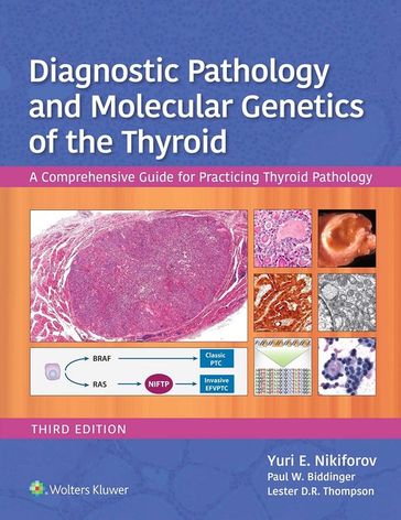 Diagnostic Pathology and Molecular Genetics of the Thyroid - Lester D.R. Thompson - Paul W. Biddinger - Yuri E. Nikiforov