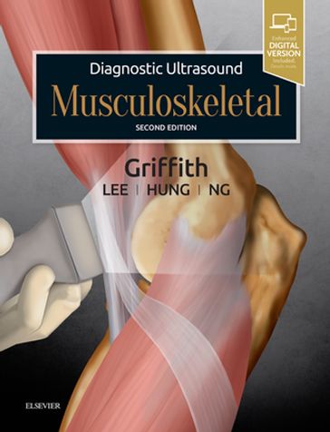 Diagnostic Ultrasound: Musculoskeletal E-Book - James F. Griffith - MD - MRCP - FRCR