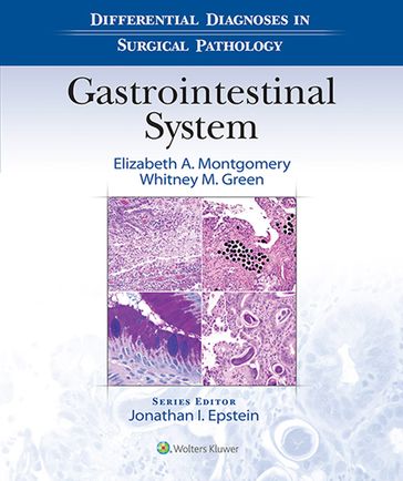 Differential Diagnoses in Surgical Pathology: Gastrointestinal System - Elizabeth A. Montgomery - Whitney M. Green