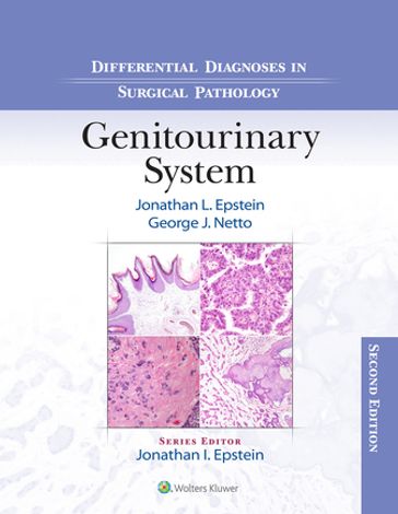 Differential Diagnoses in Surgical Pathology: Genitourinary System - George J Netto - Jonathan Epstein