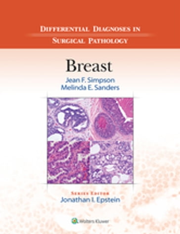 Differential Diagnoses in Surgical Pathology: Breast - Jean F. Simpson - Melinda E. Sanders