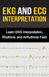 EKG and ECG Interpretation
