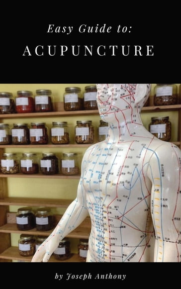 Easy Guide to: Acupuncture - Anthony Joseph