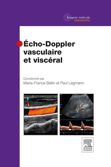 Echo-Doppler vasculaire et viscéral - Marie-France Bellin - Paul Legmann - Michel BLERY