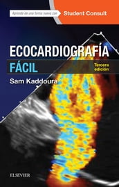 Ecocardiografía fácil