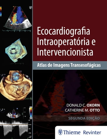 Ecocardiografia Intraoperatória e Intervencionista - Catherine M. Otto - Donald C. Oxorn