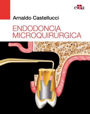 Endodoncia microquirúrgica - Arnaldo Castellucci