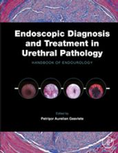 Endoscopic Diagnosis and Treatment in Urethral Pathology