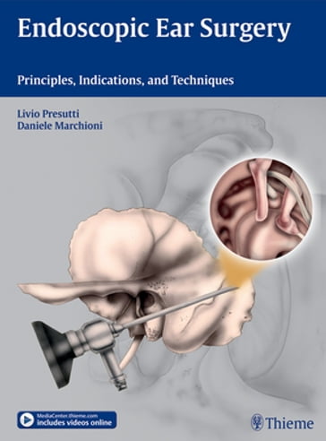 Endoscopic Ear Surgery - Livio Presutti - Daniele Marchioni