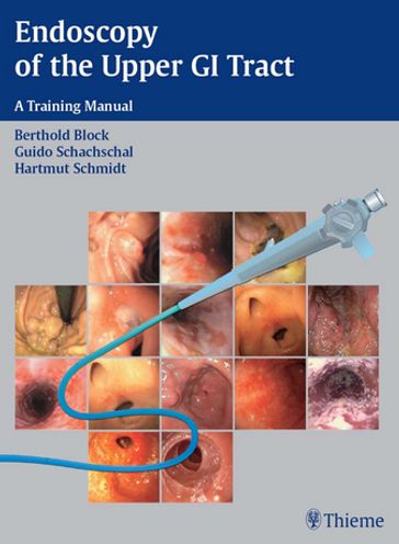 Endoscopy of the Upper GI Tract - Berthold Block - Guido Schachschal - Hartmut H.-J. Schmidt