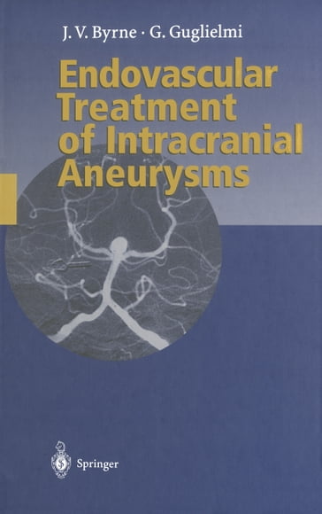 Endovascular Treatment of Intracranial Aneurysms - James Byrne - Guido Guglielmi