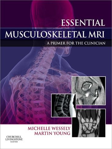 Essential Musculoskeletal MRI - Michelle Anna Wessely - Martin Ferrier Young