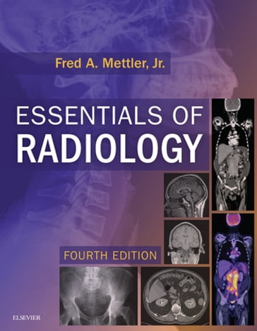 Essentials of Radiology E-Book - Fred A. Mettler - MD - MPH