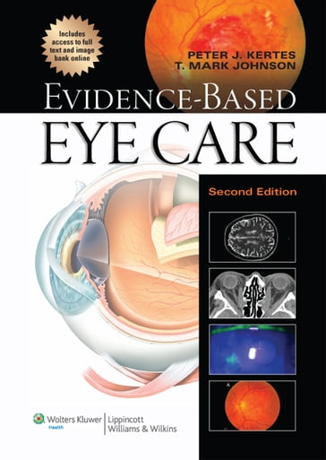 Evidence-Based Eye Care - Peter J. Kertes - T. Mark Johnson