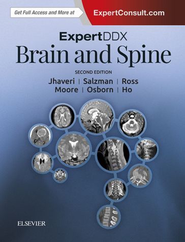 ExpertDDx: Brain and Spine - MD Karen L. Salzman - MD Jeffrey S. Ross - MD  FACR Anne G. Osborn - MD Chang Yueh Ho - MD  MBA Miral D. Jhaveri