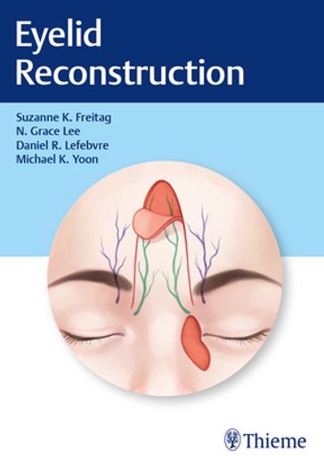 Eyelid Reconstruction - Suzanne K. Freitag - Nahyoung Grace Lee - Daniel R. Lefebvre - Michael K. Yoon