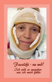 Facelift - na und?